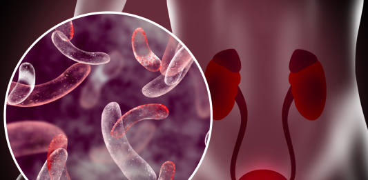 Intervento prostata in laparoscopia Castelli Romani Intervento prostata in laparoscopia Castelli Romani