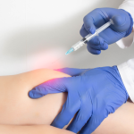 Ozonoterapia ernie discali Roma